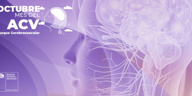 Columna de opinión: «Ataque Cerebro Vascular: ¿Por qué prevenirlo?»