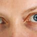 Columna de opinión: El glaucoma es la primera causa de pérdida de la visión irreversible en el mundo.