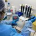 Instituto de Salud Pública certifica al Laboratorio de Biología Molecular del HRC para realizar test de detección de Hanta