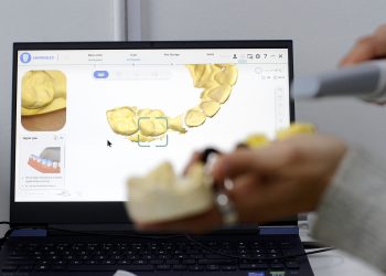 Hospital de Puerto Aysén cuenta con scanner intraoral 3D