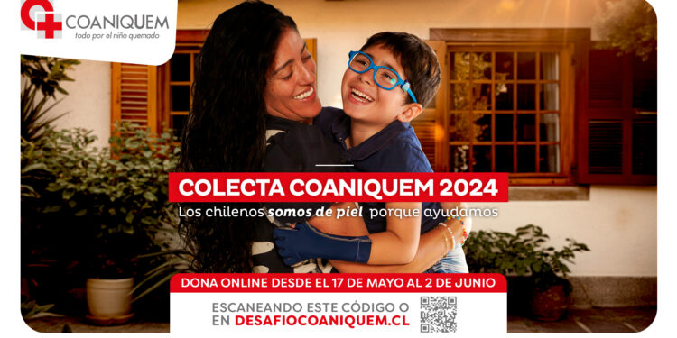 COANIQUEM inicia colecta para rehabilitación y prevención de quemaduras en niños