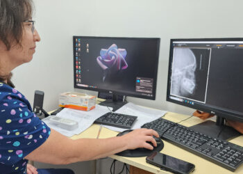 Hospital Regional Coyhaique incorpora moderno TAC Dental para fortalecer diagnóstico odontológico